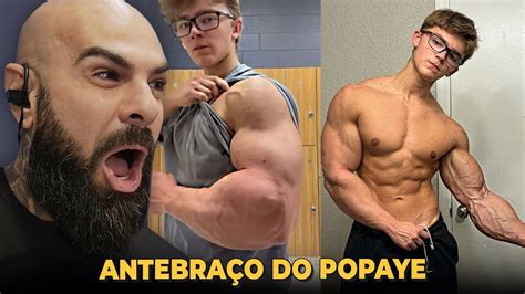 Maior Antebraço Do Mundo - 6