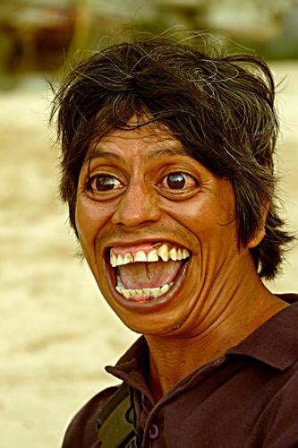 Deformed Face - he should have a paper bag over his head