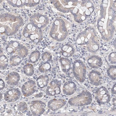 DPCD Antibody (PA5-57739)