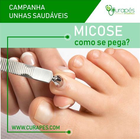 Como Se Pega Micose