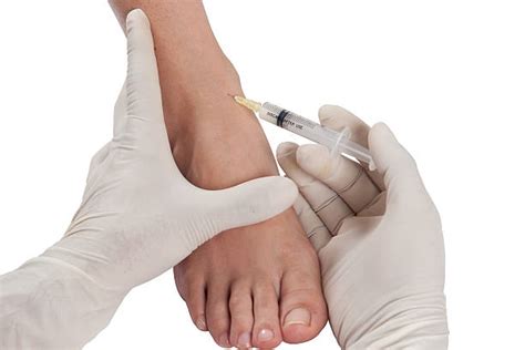 Rheumatoid Arthritis Injection Stock Photos, Pictures & Royalty-Free ...