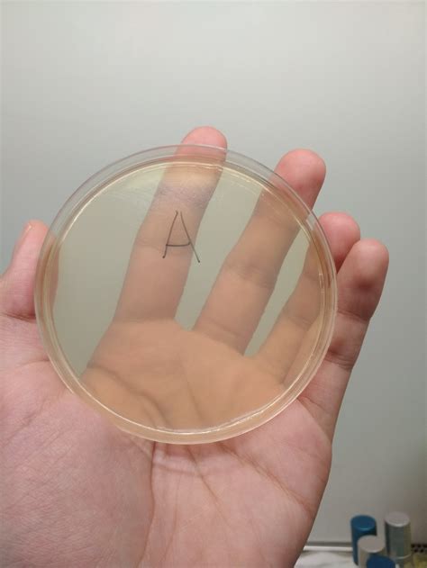 Эффективность популярного пробиотика | Пикабу