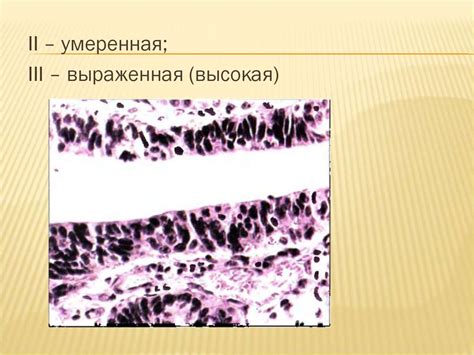 Рак желудка - презентация онлайн