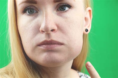 Why Do I Wake Up With Face Swollen at Ted William blog