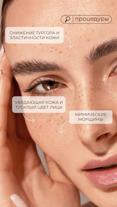 Коктейль монако #косметология #инъекции #пилинг #пилинги #омоложение # ...