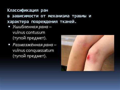 vulnus РАНЫ Раны Рана vulnus повреждение