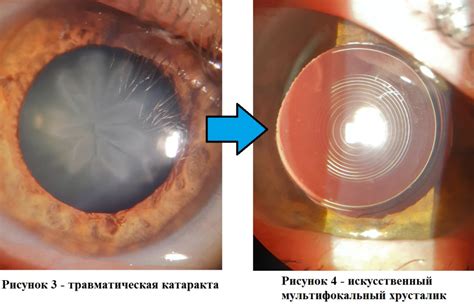 Перечень услуг ГК Ирис Пенза