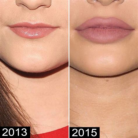 Plastic Surgery? See Kylie Jenners Body Change Over Time | Life & Style