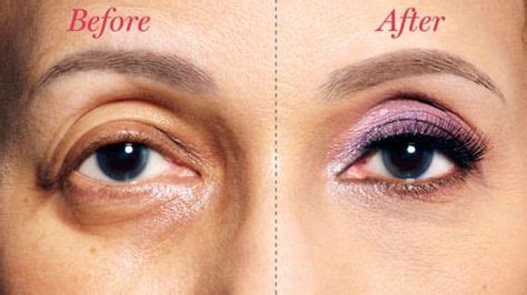 Возрастной макияж для нависших век | Droopy eyelids, Natural remedies ...