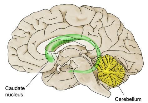 Brain Imaging Reveals Structural Defects – Understanding Fetal Alcohol ...