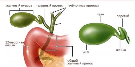 Перегиб желчного пузыря: симптомы и лечение у взрослых в домашних условиях