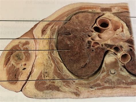 pleura transverse section  thorax inferior view diagram