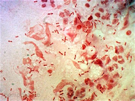 Moraxella