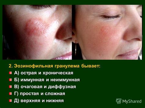 Презентация на тему: "Вопросы.:1-Общая характеристика воспалительных ...
