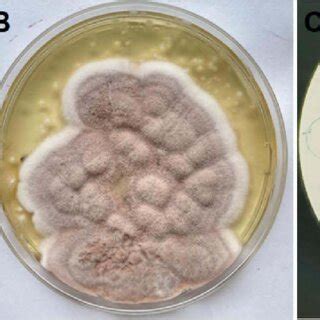 Microscopic findings, fungal colony morphology, and slide culture ... 