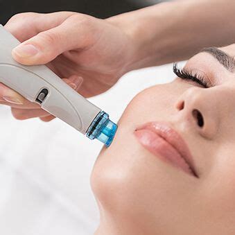 Treating Rosacea with Laser & Light Therapy - Westlake Dermatology