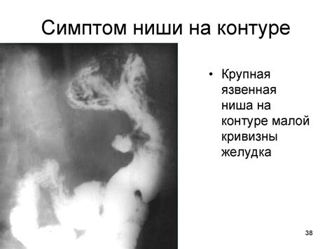 Лучевое исследование пищеварительного канала - презентация онлайн