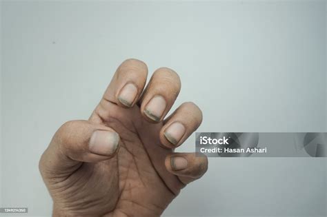 Closeup Tangan Dengan Kuku Kotor Foto Stok - Unduh Gambar Sekarang ...