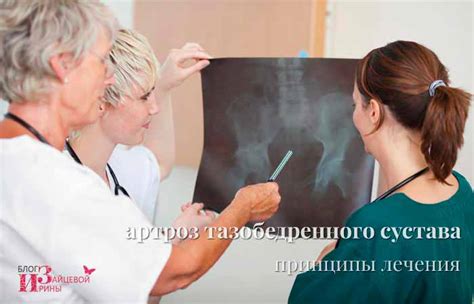 Артроз (коксартроз) тазобедренного сустава симптомы и лечение