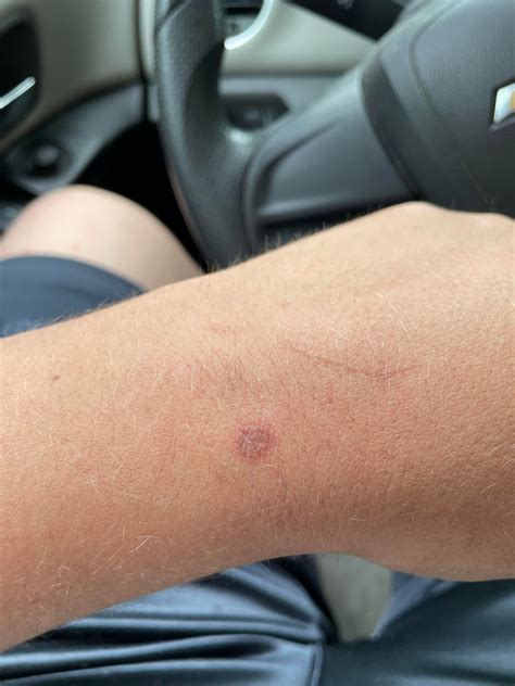 Weird underarm rash. Just noticed this and wonder if anyone has a clue