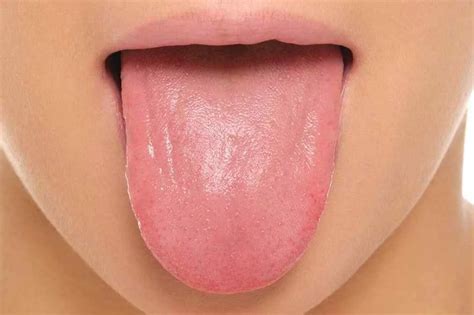 common tongue diseases   affect