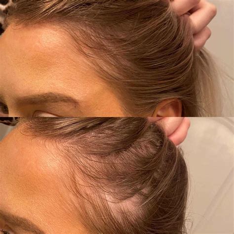 Video: How to Apply VEGAMOUR Hair Serums