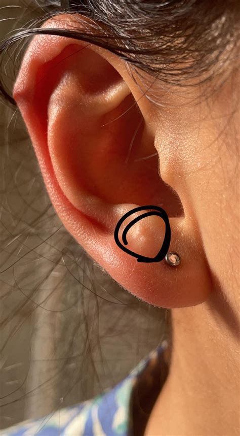 little bumps after lobe piercing, normal? : r/piercing