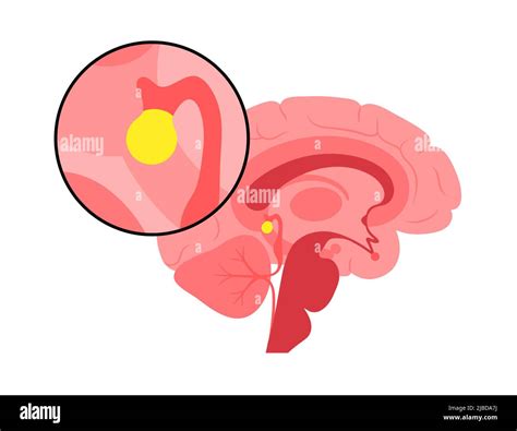 Pineal gland, illustration Stock Photo - Alamy
