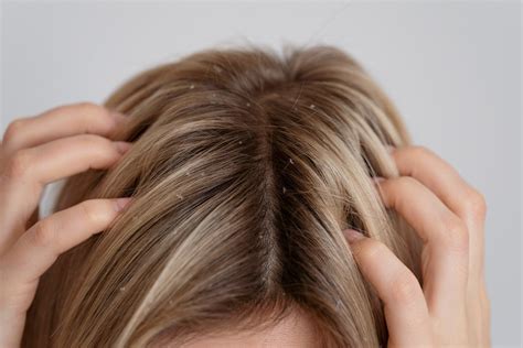 Dầu xả Selsun dưỡng tóc dành cho tóc gàu Selsun Anti-Dandruff ...