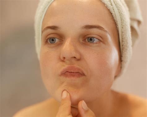 7 Skin Bumps That Aren’t Acne You Might Be Overlooking