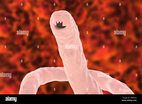 hookworm jamaica  terry haskell blog