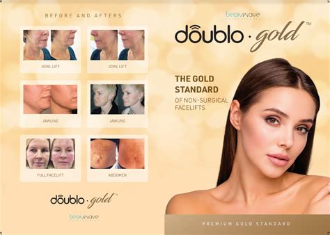 Everything you need to know about the new Doublo Gold – Younique Aesthetics