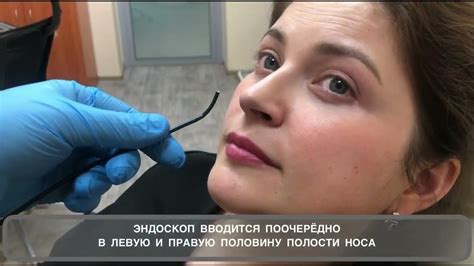 Эндоскопия носа, гибким эндоскопом. - YouTube