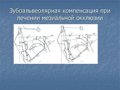 Мезиальная окклюзия - презентация онлайн