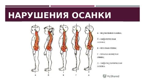Презентация "Осанка человека"