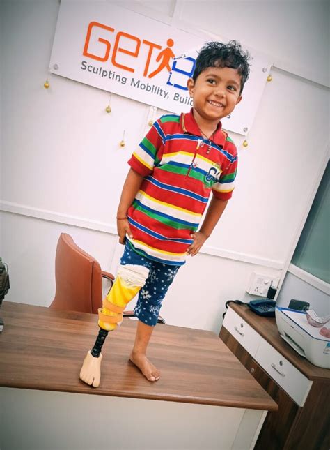 Empower 10 kids in India with Prosthetic Limbs - GlobalGiving