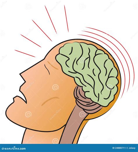 Concussion And Head Trauma Or Injury Types From Medical View Outline