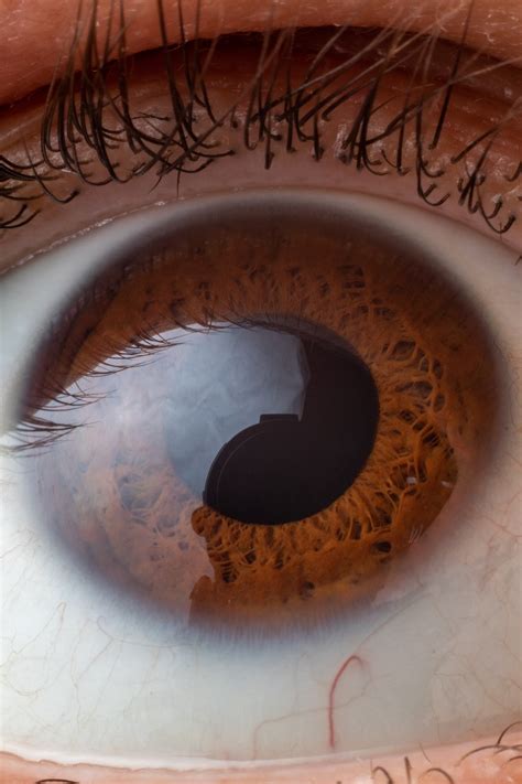 Eye Clear See - Free photo on Pixabay