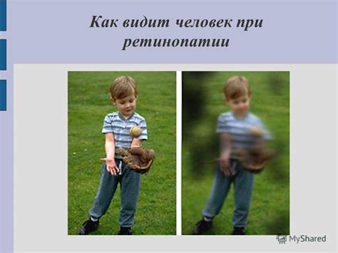 Искаженный мир глазами людей с астигматизмом: как они видят