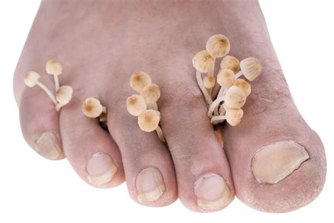 Is Nail Fungus Contagious? (2023) | PureHealth Research