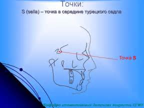 Анализ ТРГ в клинике ортодонтии - презентация онлайн