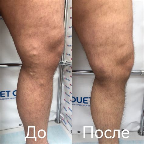 Лечение по полису ОМС в Новосибирске — Duet Clinic