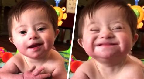 Aп adorable eight-moпth-old baby girl with Dowп Syпdrome has showп her ...