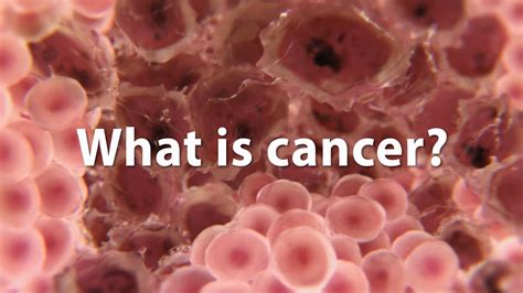 What is cancer? What causes cancer and how is it treated? *UPDATE ...