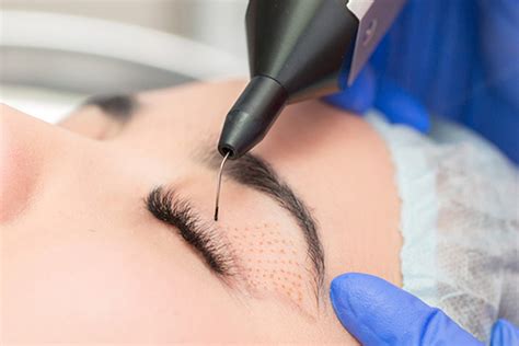 Plexr - estetické zákroky | Health & Beauty Clinic
