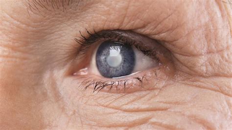 É Normal Conseguir Desfocar A Visão Quando Quiser - Visão desfocada – como controlar problemas nos olhos que afetam sua ...