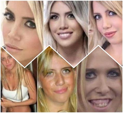 wanda nara prima chirurgia - Bite Of The Week