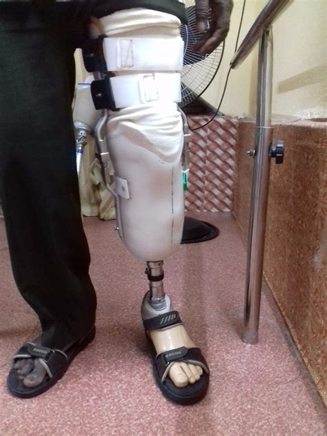 extension bk prosthesis  rs  prosthetic knee  kolkata id