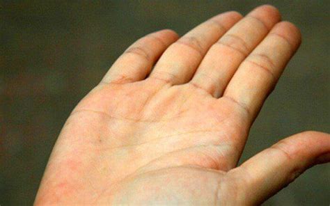 Gan nhiễm mỡ là gì? Những điều có thể bạn chưa biết