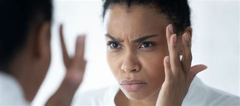 how to get rid of frown lines